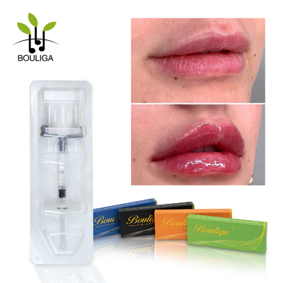 Long Lasting Crosslinked hyaluronic acid Dermal  Filler For Lips Enchance
